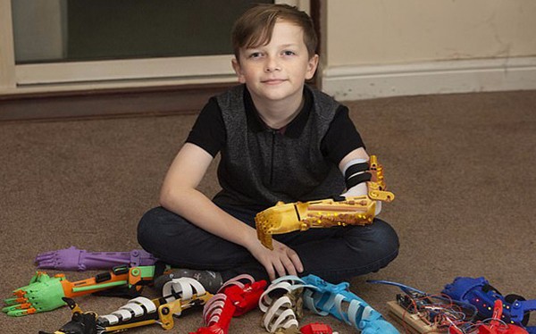 感动!英父亲为无臂儿子3D打印9只个性仿生臂