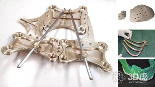 【探讨】FDM 3D打印到底有没有应用性?(图2) 【探讨】FDM 3D打印到底有没有应用性?(图2)