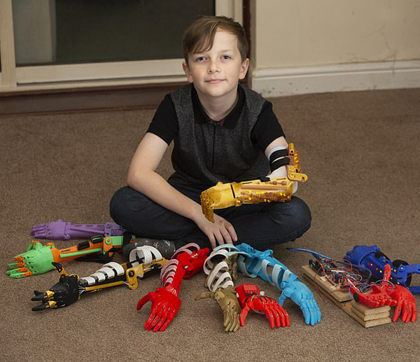 感动!英父亲为无臂儿子3D打印9只个性仿生臂(图1) 感动!英父亲为无臂儿子3D打印9只个性仿生臂(图1)