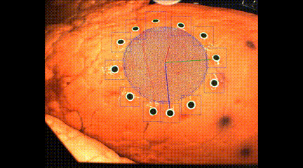 3D打印新成果!新技术或将助力诊断监测新冠肺炎(图2) 3D打印新成果!新技术或将助力诊断监测新冠肺炎(图2)